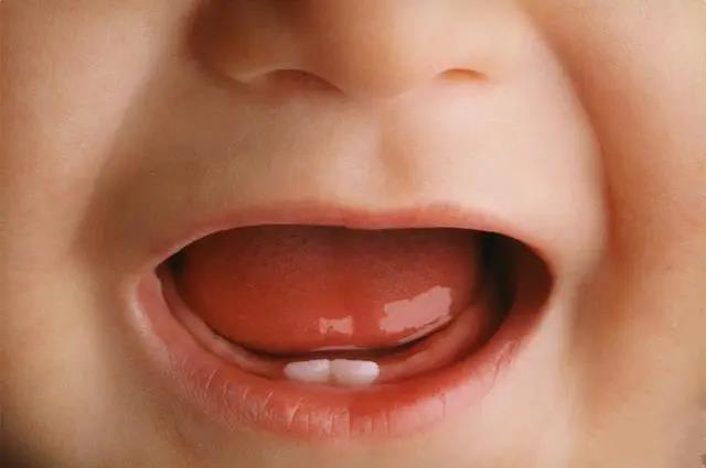 寶寶幾個(gè)月長(zhǎng)牙？多留意出牙前的這4個(gè)“信號(hào)”